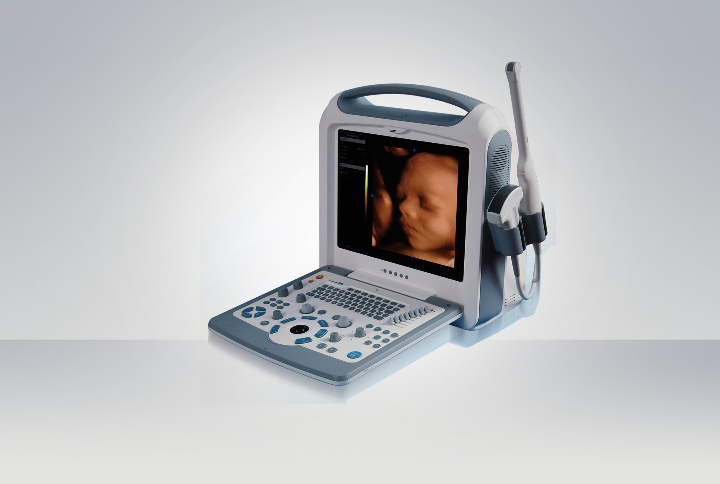 Color Doppler Ultrasonic Scanner