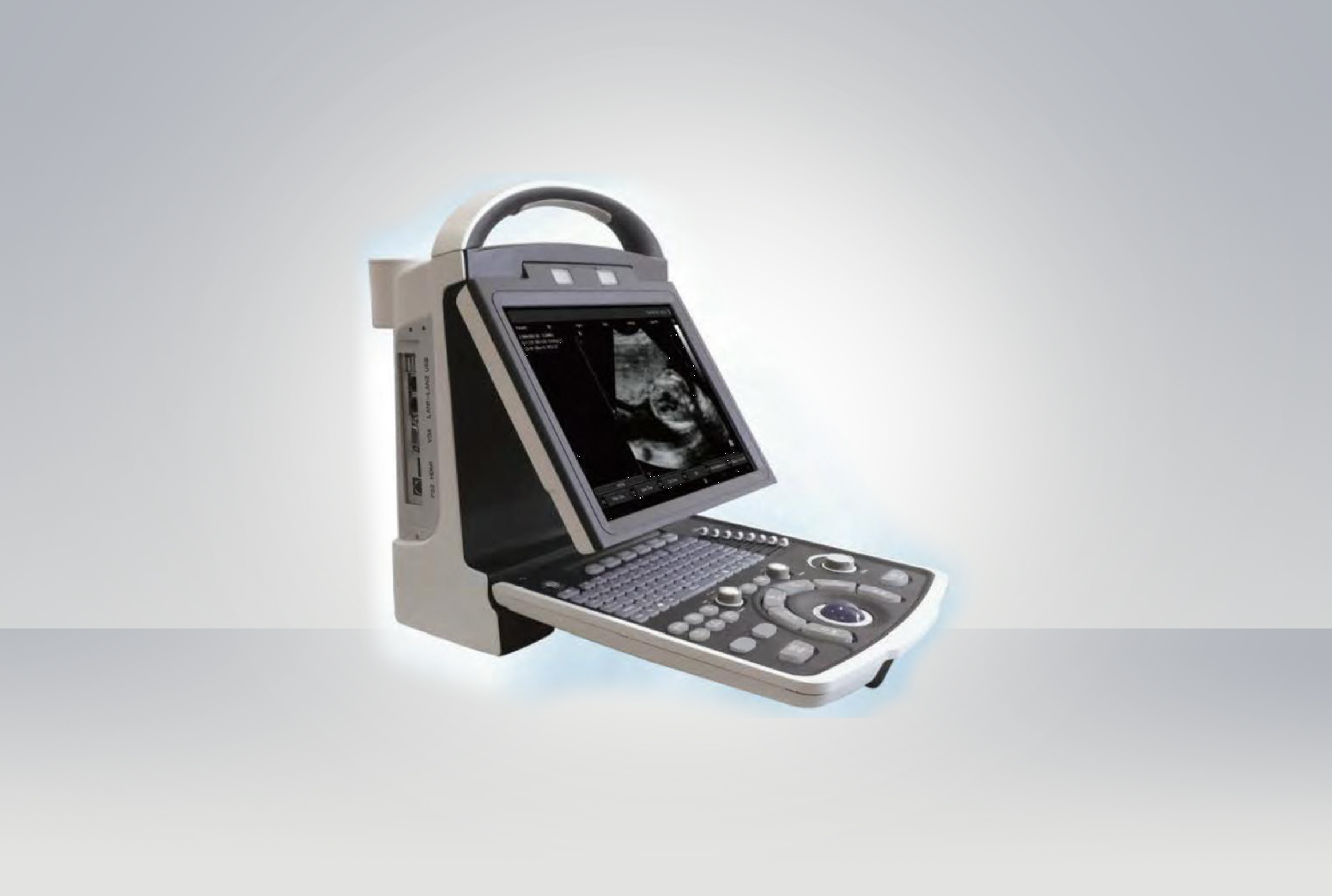 Ultrasound Scanner