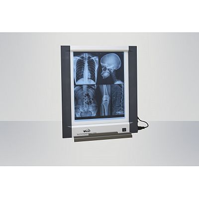 X-ray Film Viewer